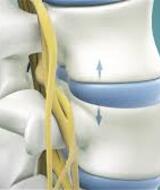 Book an Appointment with Spinal Decompression Therapy at (St. Paul) Vitality Chiropractic & Wellness