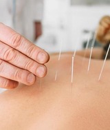 Book an Appointment with Acupuncture with localized Infrared Red Therapy at (Prior Lake) Vitality Chiropractic & Wellness